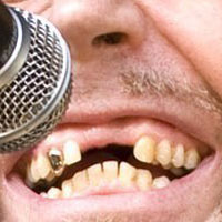 The Worst Teeth In Music - Part Two